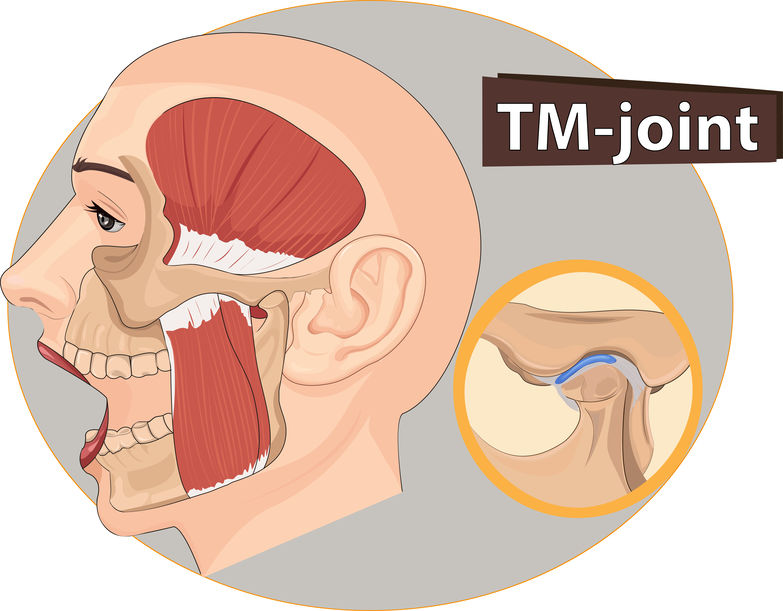 TMJ / TMD - Dentist West Edmonton - Copperwood Dental