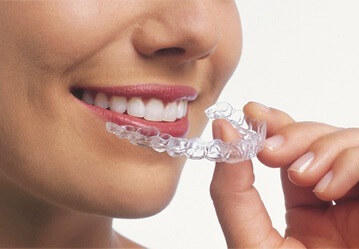 Invisalign in West Edmonton